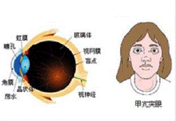 希瑪林順潮眼科中心_眼整形_甲亢突眼